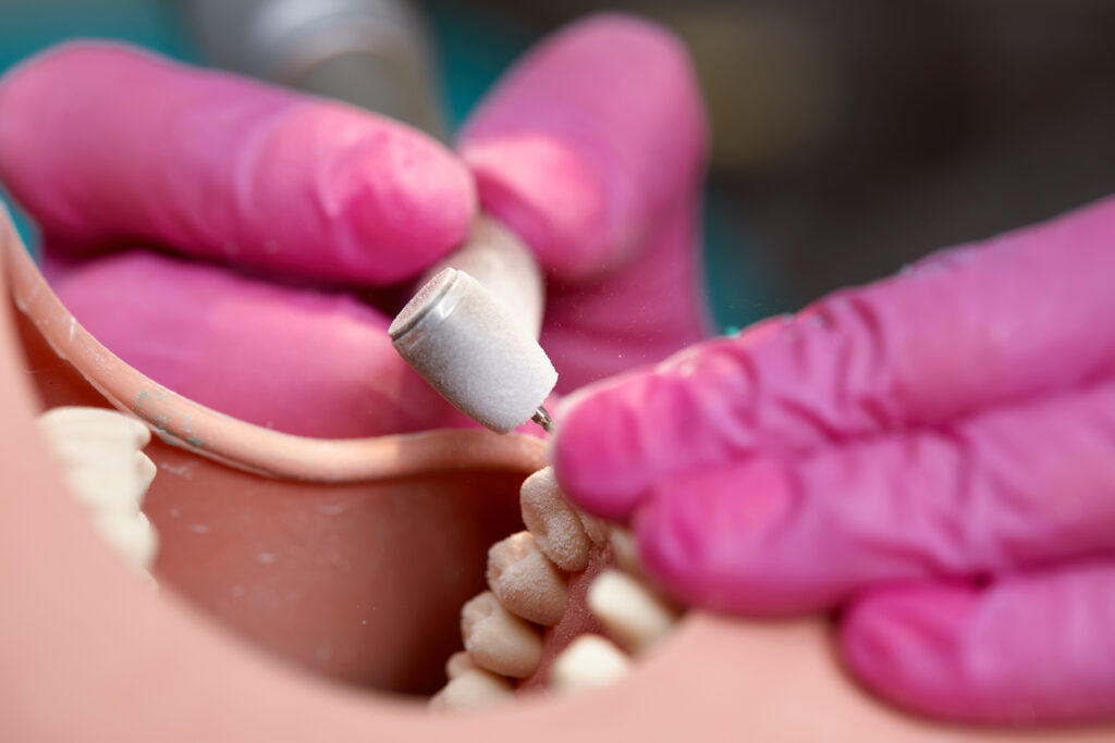 impianti osteointegrati